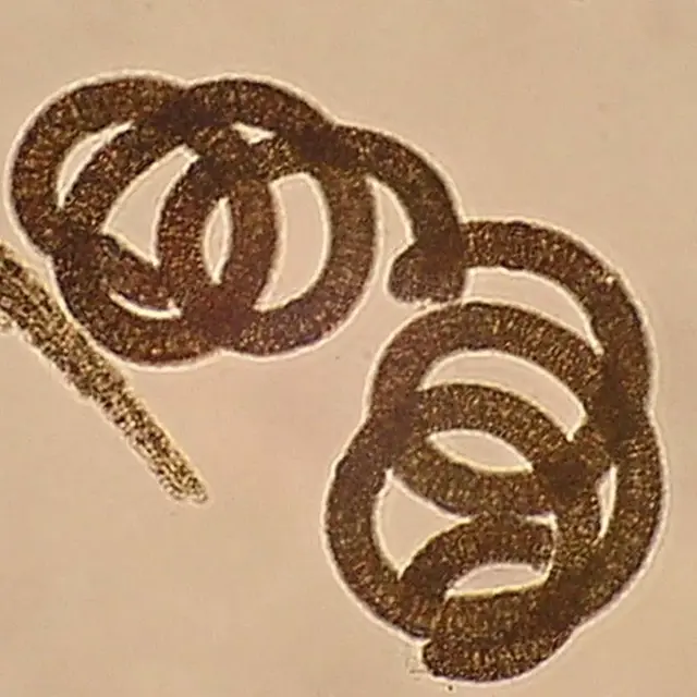 Nodularia spumigena
